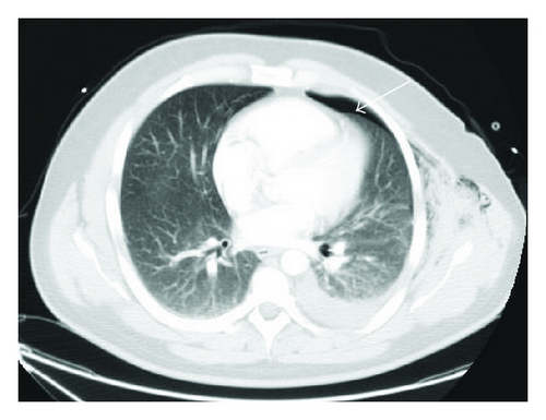 Details are in the caption following the image Details are in the caption following the image