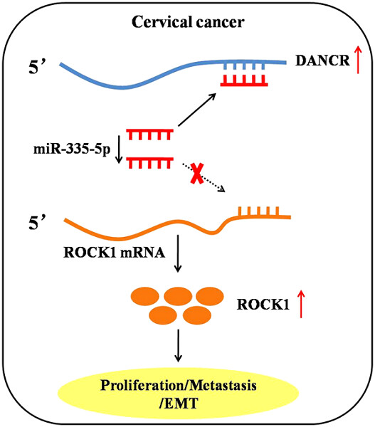 LncRNA DANCR promotes cervical cancer progression by upregulating ROCK1 via sponging miR-335-5p