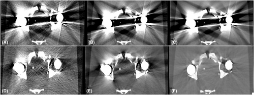 Details are in the caption following the image Details are in the caption following the image