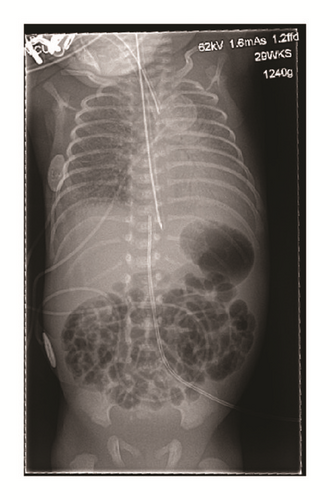 Details are in the caption following the image Details are in the caption following the image