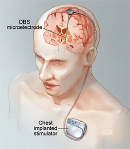 Details are in the caption following the image