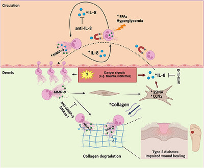 Interleukin-8/Matrix Metalloproteinase-9 Axis Impairs Wound Healing in Type 2 Diabetes through Neutrophil Extracellular Traps-Fibroblast Crosstalk