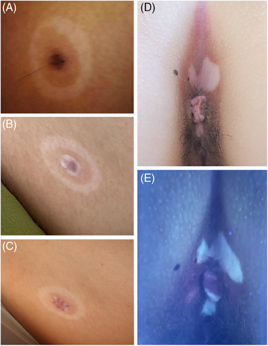 Details are in the caption following the image Details are in the caption following the image