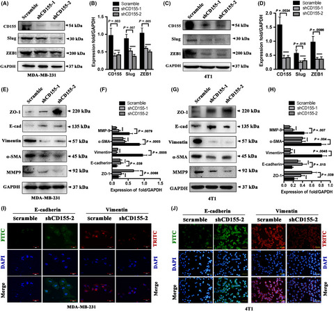 CD155 contributes to the mesenchymal phenotype of triple-negative breast cancer