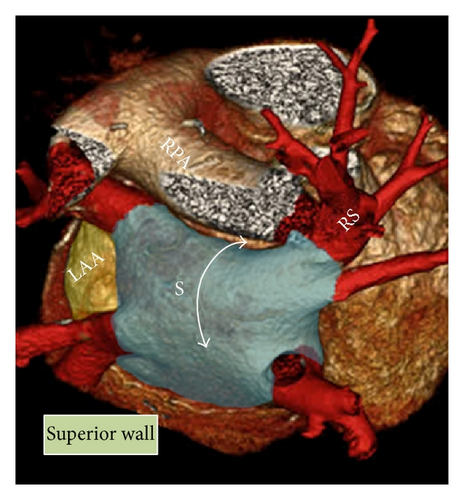 Details are in the caption following the image