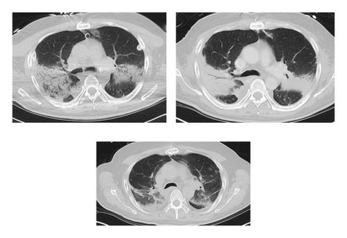 Details are in the caption following the image Details are in the caption following the image