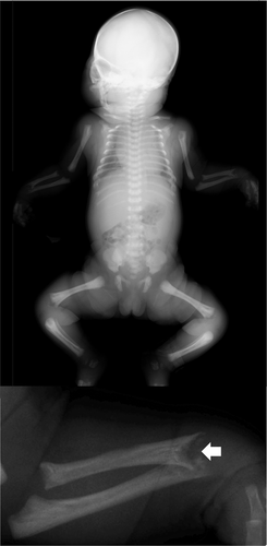Details are in the caption following the image