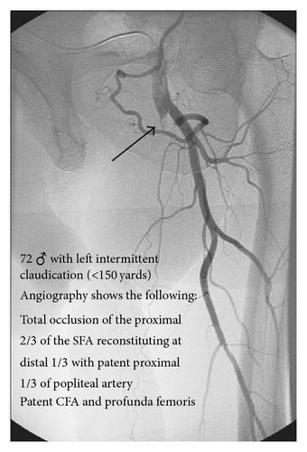 Details are in the caption following the image