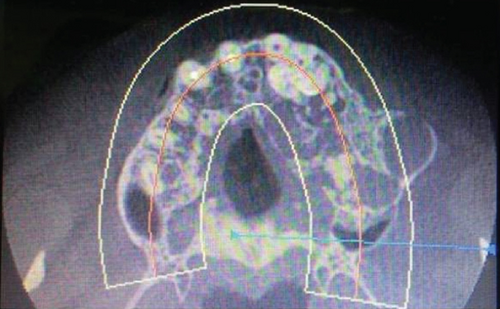Details are in the caption following the image Details are in the caption following the image