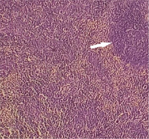 Details are in the caption following the image