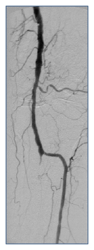 Details are in the caption following the image