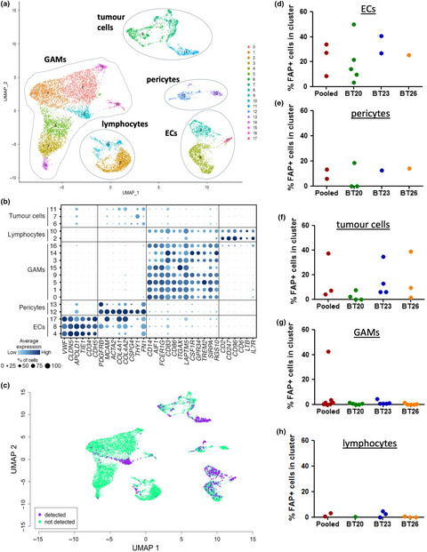 Endothelial, pericyte and tumor cell expression in glioblastoma identifies fibroblast activation protein (FAP) as an excellent target for immunotherapy