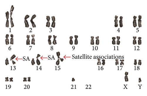 Details are in the caption following the image