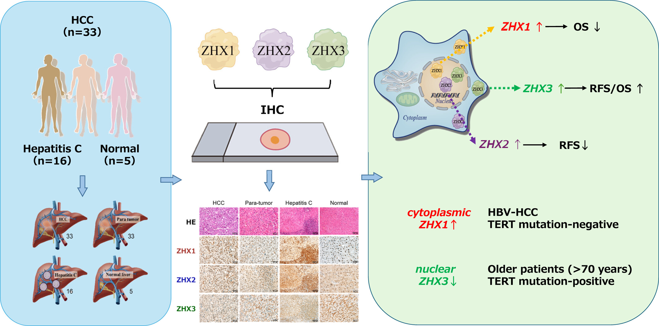 Elevated nuclear expression of ZHX1 correlates with poor prognosis in hepatocellular carcinoma (HCC): Comparison of nuclear and cytoplasmic distribution of the ZHX family in HCC cells