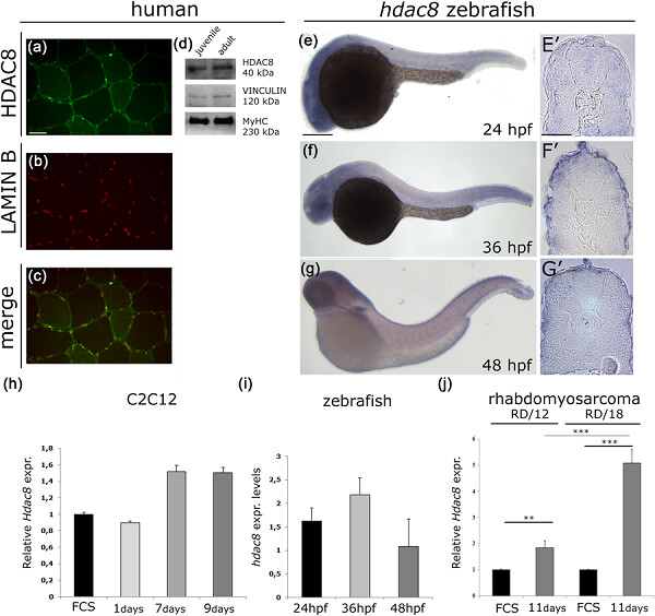 HDAC8 regulates canonical Wnt pathway to promote differentiation in skeletal muscles