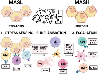 The “Domino effect” in MASLD: The inflammatory cascade of steatohepatitis