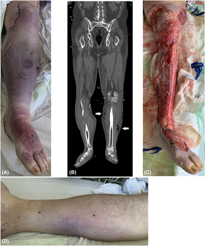 Details are in the caption following the image Details are in the caption following the image