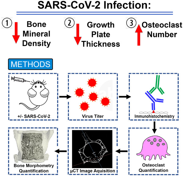 Acute bone loss following SARS-CoV-2 infection in mice