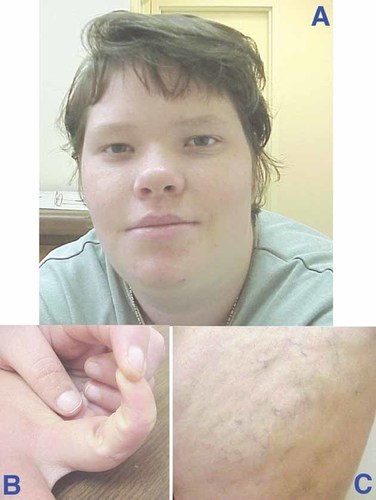 Details are in the caption following the image Details are in the caption following the image