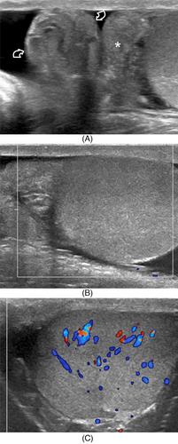 Details are in the caption following the image