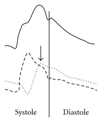 Details are in the caption following the image
