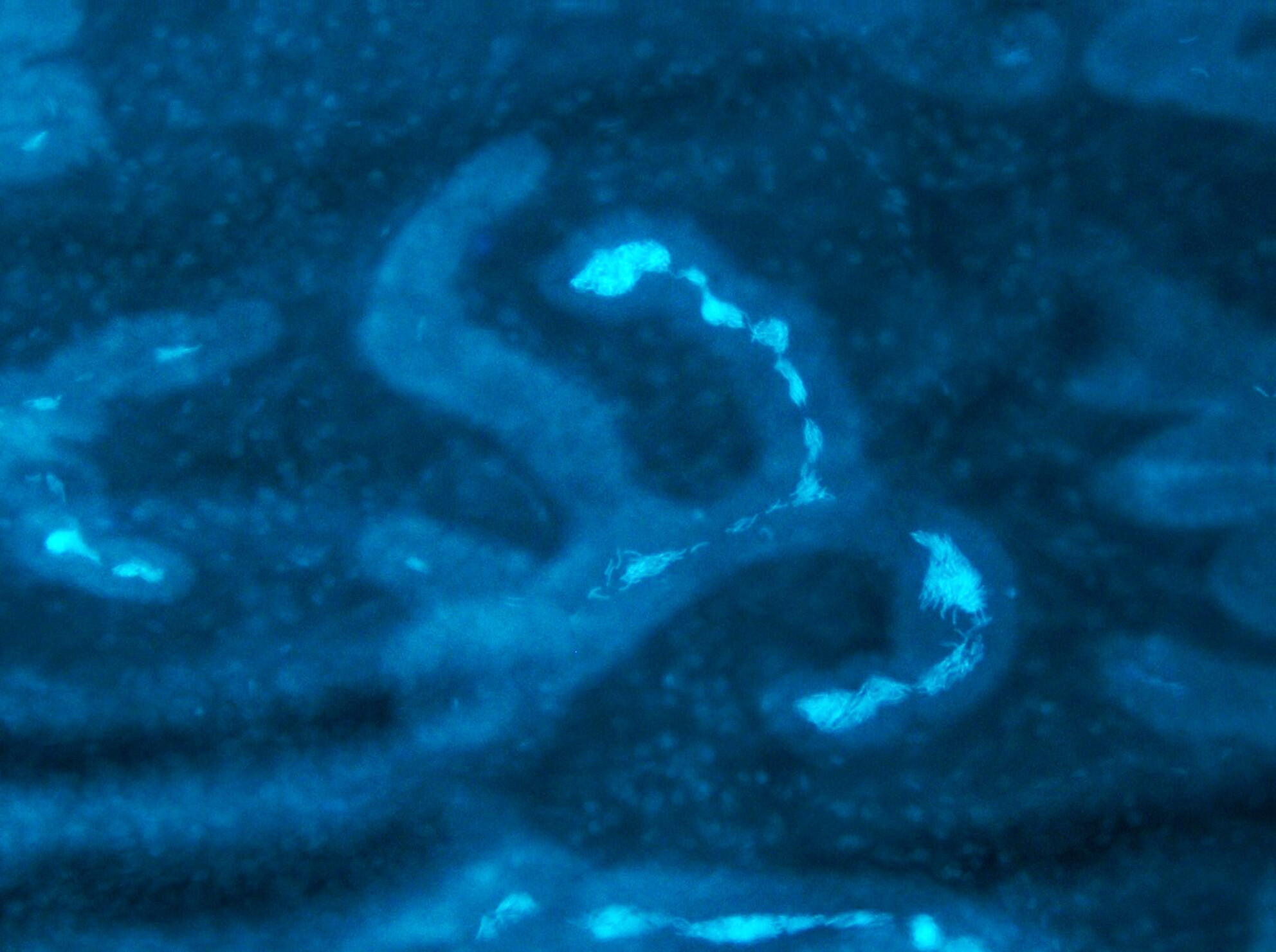 The surprising complexity and diversity of sperm storage structures across Galliformes