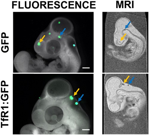 Evaluating the effectiveness of transferrin receptor-1 (TfR1) as a magnetic resonance reporter gene