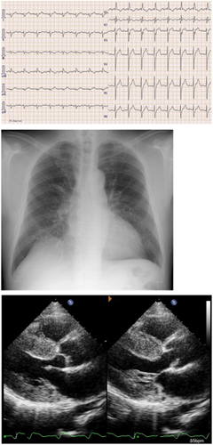 Details are in the caption following the image