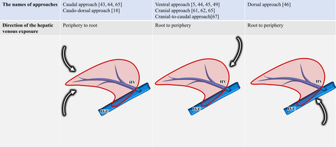 Landmarks and techniques to perform minimally invasive liver surgery: A systematic review with a focus on hepatic outflow