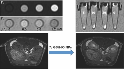 One-Step, Room-Temperature Synthesis of Glutathione-Capped Iron-Oxide Nanoparticles and their Application in In Vivo T1-Weighted Magnetic Resonance Imaging