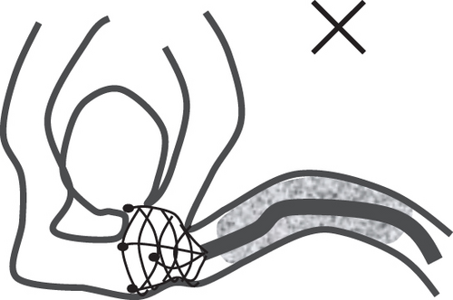 Details are in the caption following the image