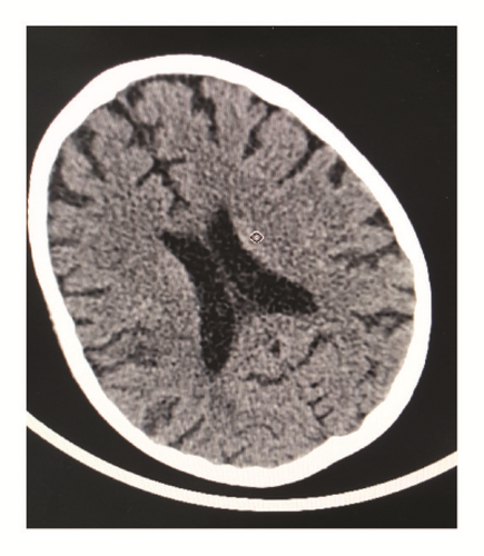 Details are in the caption following the image