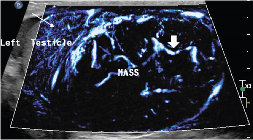 Details are in the caption following the image