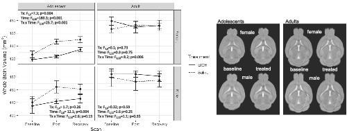 Alcohol's effects on the mouse brain are modulated by age and sex