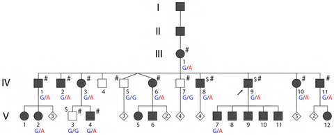 A novel essential splice site variant in SPTB in a large hereditary spherocytosis family