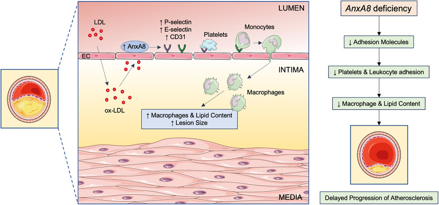 Annexin A8 deficiency delays atherosclerosis progression