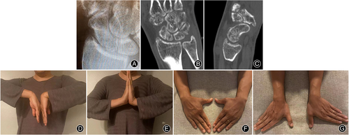 Details are in the caption following the image Details are in the caption following the image