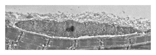 Details are in the caption following the image