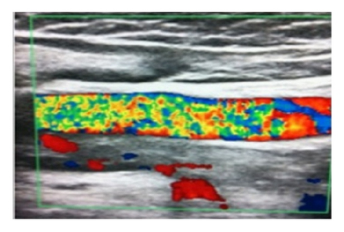 Details are in the caption following the image Details are in the caption following the image