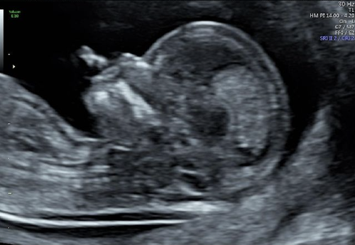 Details are in the caption following the image