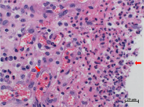 Details are in the caption following the image Details are in the caption following the image