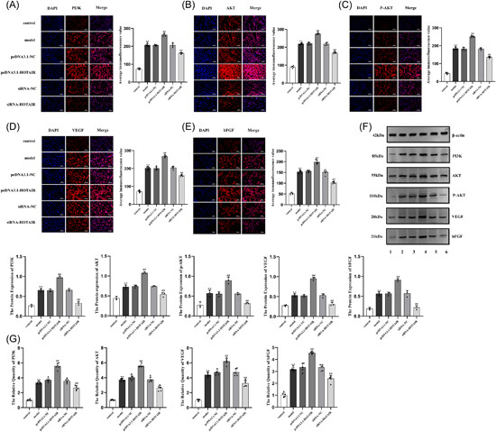 LncRNA HOTAIR regulates the PI3K/AKT pathway via the miR-126-3p/PIK3R2 axis to participate in synovial angiogenesis in rheumatoid arthritis