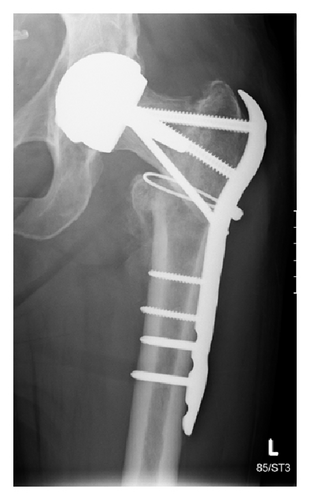 Details are in the caption following the image Details are in the caption following the image