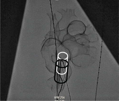 Details are in the caption following the image Details are in the caption following the image