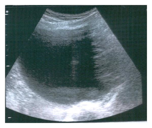 Details are in the caption following the image