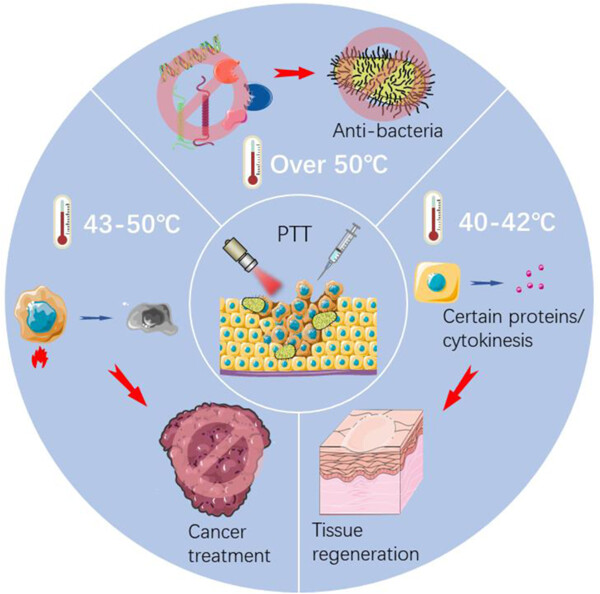 Biomedical applications and prospects of temperature-orchestrated photothermal therapy Issue 2, 2022