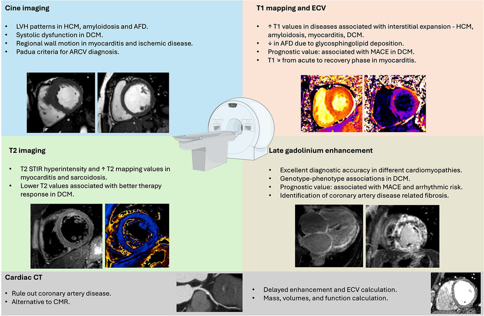 CT and MR Imaging of Cardiomyopathies in Clinical Practice–An Approach After an Abnormal Echocardiogram or Electrocardiogram