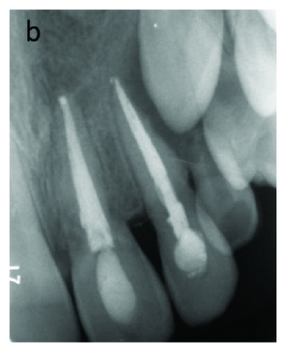 Details are in the caption following the image