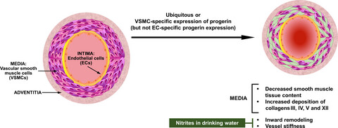 Vascular smooth muscle cell-specific progerin expression in a mouse model of Hutchinson–Gilford progeria syndrome promotes arterial stiffness: Therapeutic effect of dietary nitrite