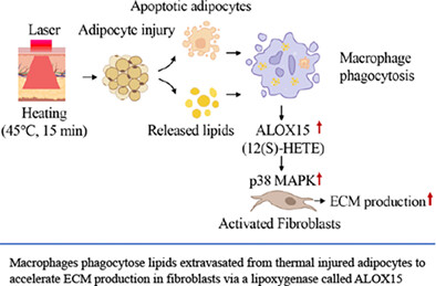 Photothermal lipolysis accelerates ECM production via macrophage-derived ALOX15-mediated p38 MAPK activation in fibroblasts